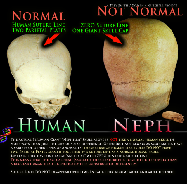 Human Skull Compared To Nephilim Skull